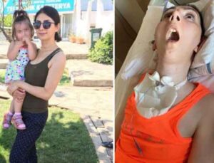 Burun estetiği yaptırmak için bıçak altına yatan kadın, 4 yıldır bitkisel hayatta