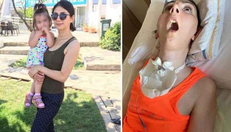 Burun estetiği yaptırmak için bıçak altına yatan kadın, 4 yıldır bitkisel hayatta