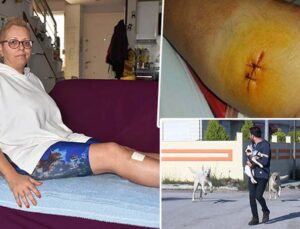 Antalya’da sokak köpeği tarafından ısırılan aşçı kadın kabusu yaşadı