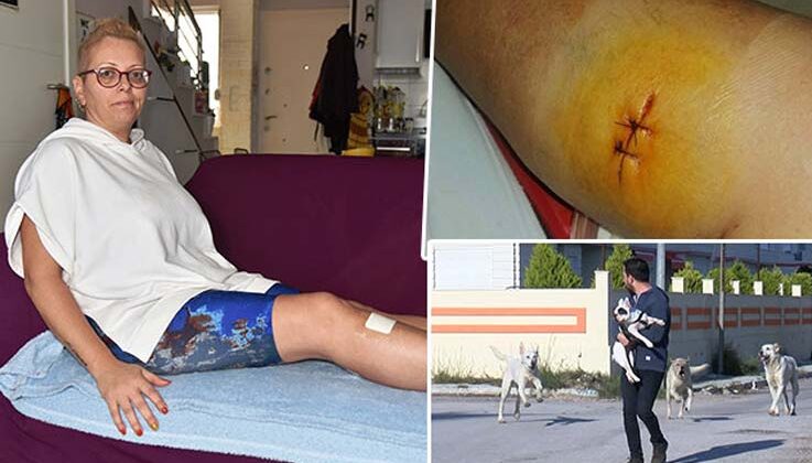 Antalya’da sokak köpeği tarafından ısırılan aşçı kadın kabusu yaşadı