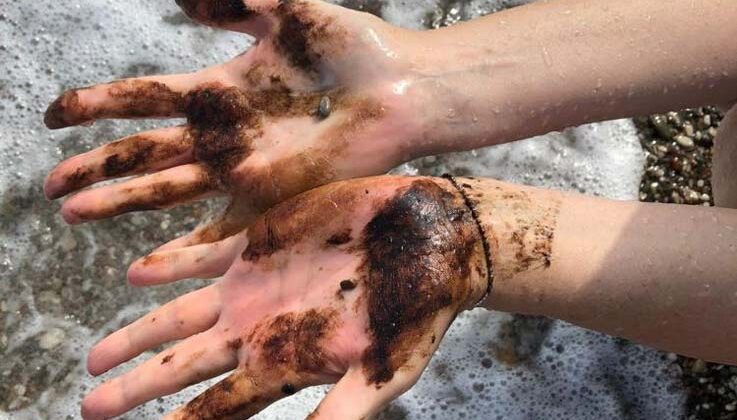 Konyaaltı Sahili’nde denize girenlerin üstüne zifti andıran bir madde yapıştı
