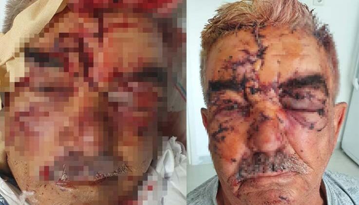 Beslediği komşusunun köpeğinin saldırısına uğradı