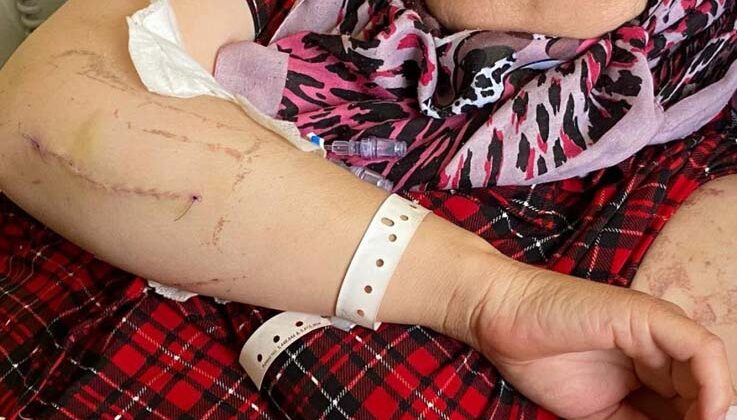 Evin elektriğini kesip kapıyı açtıran eşi tarafından 24 yerinden bıçaklandığı anları gözyaşları içinde anlattı