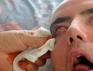 Doktorlar 6 ay ömür biçti, 10 yıldır gözlerini bir an olsun kırpmadan yaşam savaşı veriyor