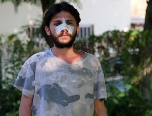 Antalya’da kiracı gence “ucuz kira” dayağı iddiası