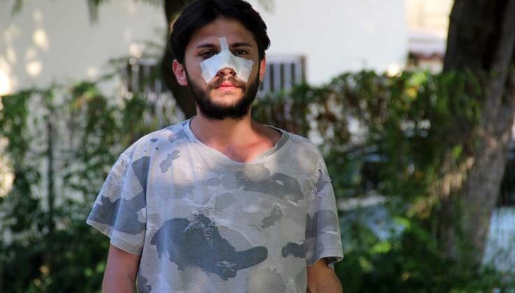 Antalya’da kiracı gence “ucuz kira” dayağı iddiası