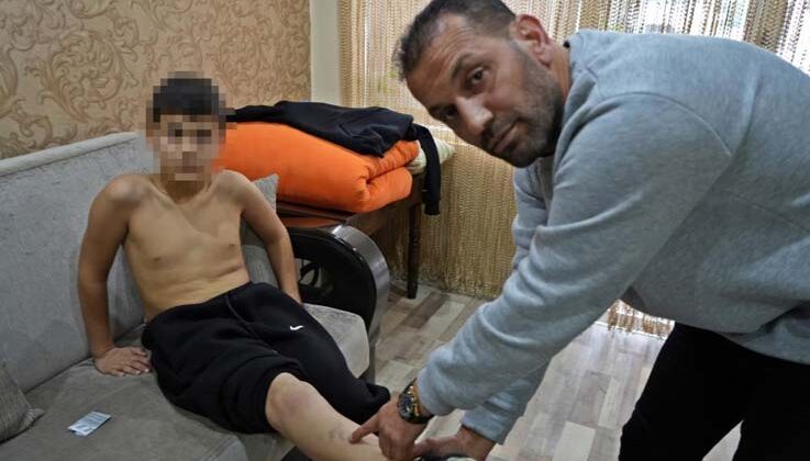 Ailesinin ‘kavga etme, şikayet gelmesin’ sözüyle akranlarının zorbalığını 2 ay boyunca sakladı