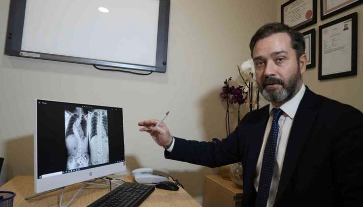 Skolyozun belirlenmesinde ailelere büyük görev düşüyor